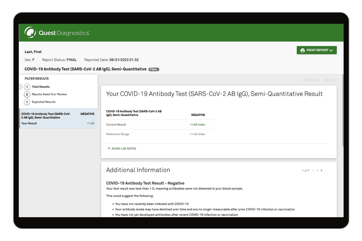 COVID-19 Antibody Test